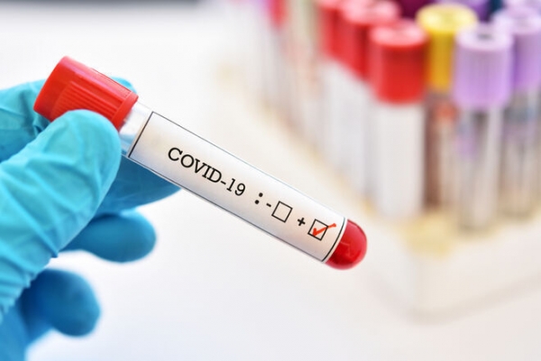
СБУ заблокировала сеть, продававшую поддельные негативные тесты на Covid-19
