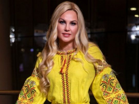 Невдало проїхалась на велосипеді: Камалія з травмами опинилась в лікарні
