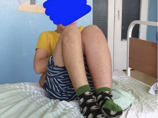 В&nbsp;Києві по-звірячому побили хлопчика: через важку травму довелось робити операцію
